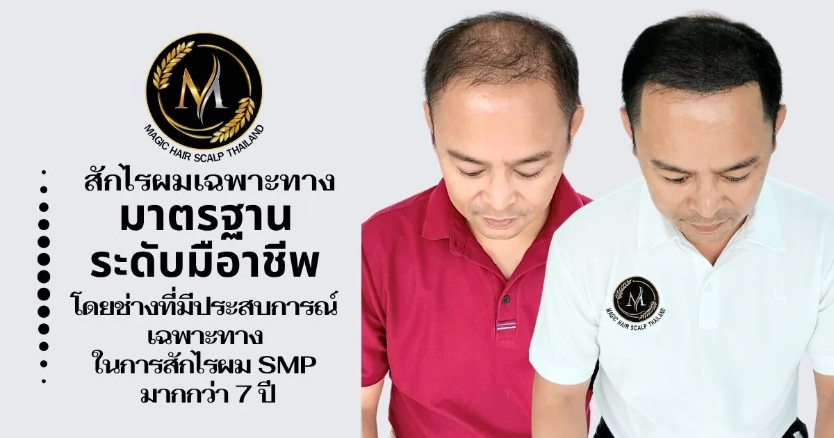 รีวิวคำแนะนำจากผู้เชี่ยวชาญการสักไรผม Magic Hair