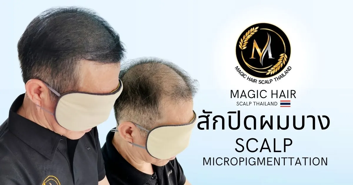 บริการสักไรผมแก้ปัญหาผมบาง